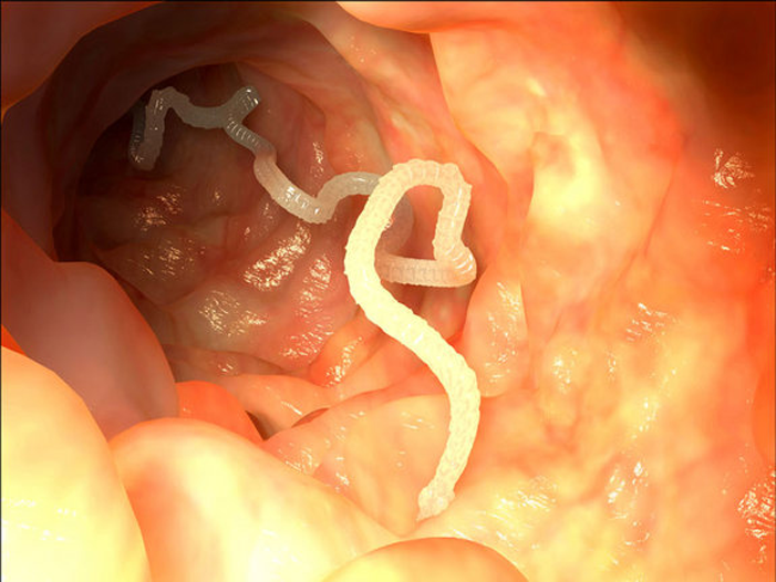 Tapeworm In A Human Colon