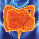 Is SIBO Causing Your IBS?
