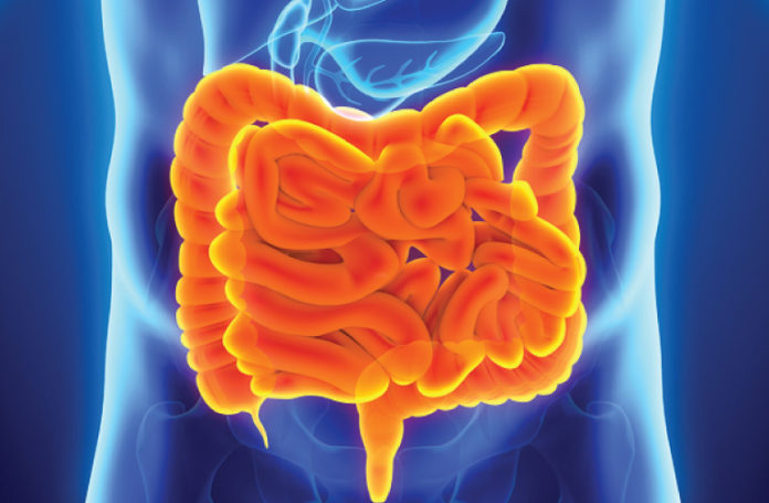Is SIBO Causing Your IBS?