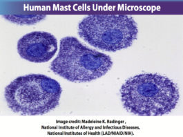 human mast cells microscope