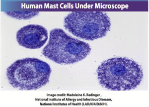 human mast cells microscope