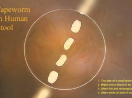 tapeworm in stool