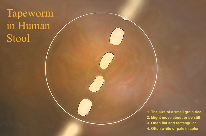 tapeworm in stool