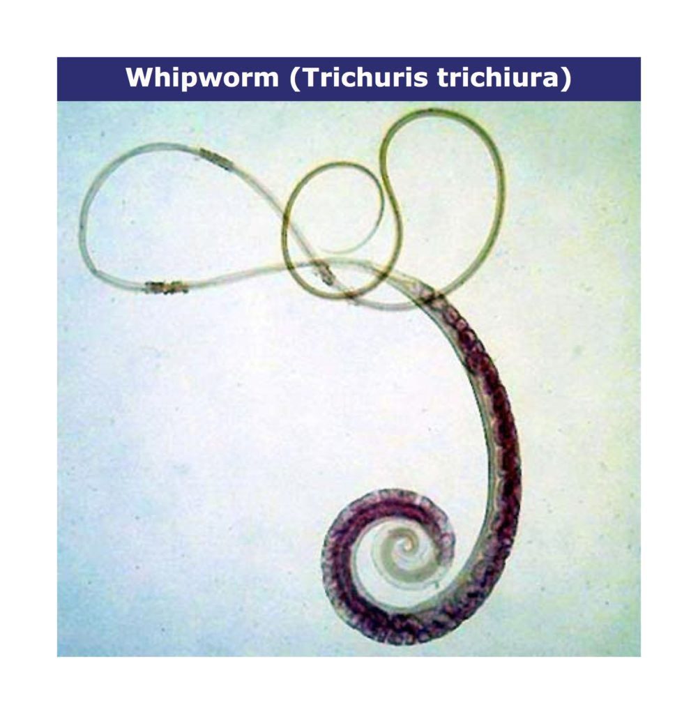 whipworm infographic