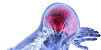 Signs of a Stroke that Women Overlook